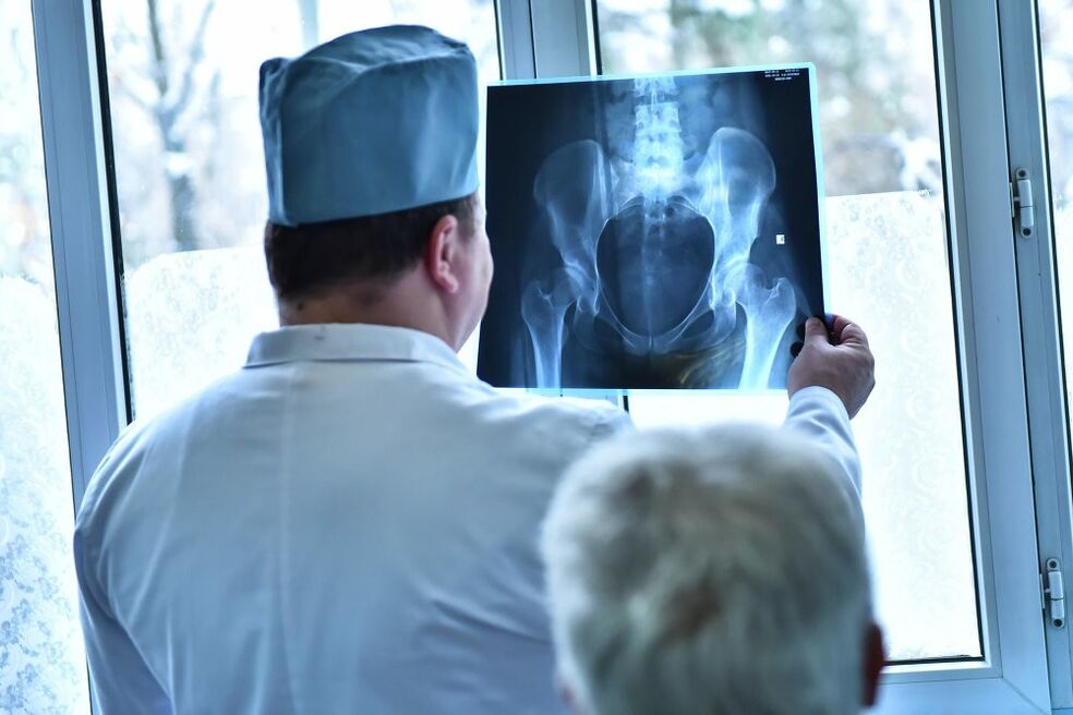 The doctor looks at a picture of an arthritic hip joint